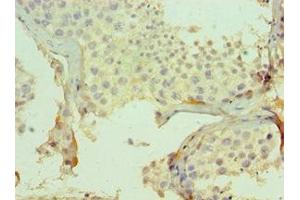 Immunohistochemistry of paraffin-embedded human testis tissue using ABIN7147732 at dilution of 1:100 (CMA1 抗体  (AA 1-247))