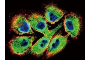 Confocal immunofluorescent analysis of EphB2 antibody with A375 cells followed by Alexa Fluor 488-conjugated goat anti-rabbit lgG (green). (EPH Receptor B2 抗体  (AA 1021-1050))