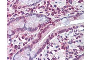 Anti-ABCC8 antibody IHC of human small intestine. (ABCC8 抗体  (N-Term))