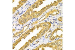 Immunohistochemistry (IHC) image for anti-Protein Kinase, AMP-Activated, alpha 1 Catalytic Subunit (PRKAA1) (AA 1-300) antibody (ABIN3021788)
