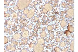 Formalin-fixed, paraffin-embedded human Thyroid stained with Thyroglobulin Mouse Recombinant Monoclonal Antibody (r6E1). (Recombinant Thyroglobulin 抗体)