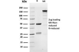 SDS-PAGE Analysis Purified MSH6 Mouse Monoclonal Antibody (MSH6/3086). (MSH6 抗体  (AA 374-540))