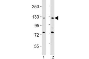 Western blot testing of AATK antibody at 1:2000 dilution. (AATK 抗体  (AA 55-90))