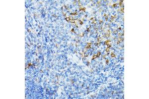 Immunohistochemistry (IHC) image for anti-Transmembrane Protein 173 (TMEM173) antibody (ABIN7270958)