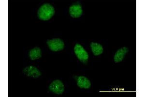 Immunofluorescence of purified MaxPab antibody to PFKFB3 on HeLa cell. (PFKFB3 抗体  (AA 1-520))