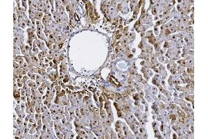 IHC analysis of Alanine Transaminase/Gpt using anti-Alanine Transaminase/Gpt antibody (ABIN7600506).