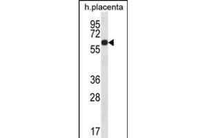 GLCCI1 Antibody (Center) (ABIN656789 and ABIN2846008) western blot analysis in human placenta tissue lysates (35 μg/lane). (GLCCI1 抗体  (AA 226-255))