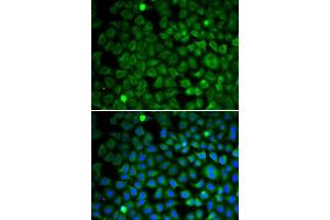 Immunofluorescence analysis of U2OS cells using NUP62 antibody (ABIN5971334). (NUP62 抗体)