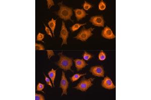 Immunofluorescence (IF) image for anti-DEAD (Asp-Glu-Ala-Asp) Box Polypeptide 58 (DDX58) (AA 726-925) antibody (ABIN6139513)