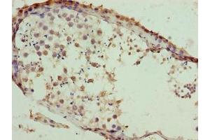 Immunohistochemistry (IHC) image for anti-Solute Carrier Family 26 (Sulfate Transporter), Member 8 (SLC26A8) (AA 414-595) antibody (ABIN7171798)