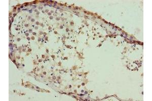 Immunohistochemistry of paraffin-embedded human testis tissue using ABIN7171798 at dilution of 1:100 (SLC26A8 抗体  (AA 414-595))