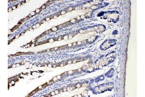 Immunohistochemistry (IHC) image for anti-Cytochrome P450, Family 2, Subfamily D, Polypeptide 6 (CYP2D6) (AA 315-347), (C-Term) antibody (ABIN5518823)