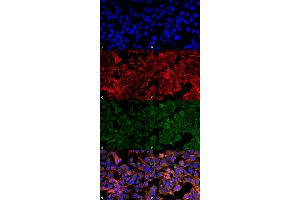 Immunocytochemistry/Immunofluorescence analysis using Mouse Anti-Malondialdehyde Monoclonal Antibody, Clone 11E3 . (Malondialdehyde 抗体  (Biotin))