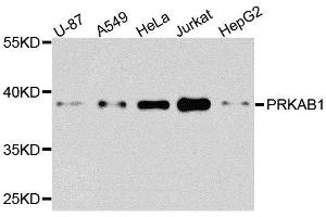 Western Blotting (WB) image for anti-Protein Kinase, AMP-Activated, beta 1 Non-Catalytic Subunit (PRKAB1) (AA 1-80) antibody (ABIN6146174)