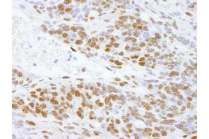 Immunohistochemistry (IHC) image for anti-DEAD (Asp-Glu-Ala-Asp) Box Polypeptide 5 (DDX5) (C-Term) antibody (ABIN7448522) (DDX5 抗体  (C-Term))