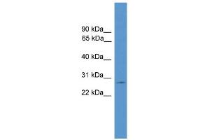 WB Suggested Anti-CLRN1 Antibody Titration: 0. (Clarin 1 抗体  (C-Term))