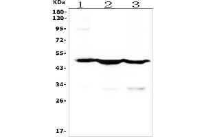 Western blot analysis of Cytokeratin 18 using anti-Cytokeratin 18 antibody (ABIN7600573).