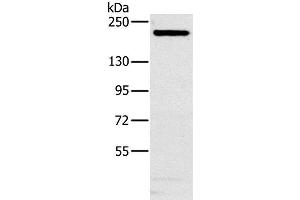 Western Blot analysis of Hela cell using NCOA3 Polyclonal Antibody at dilution of 1:200 (NCOA3 抗体)