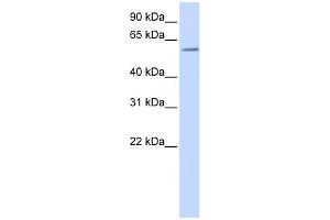 WB Suggested Anti-ZBTB7A Antibody Titration:  0. (ZBTB7A 抗体  (N-Term))