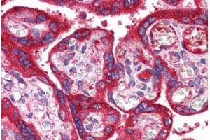 Immunohistochemistry (Formalin-fixed Paraffin-embedded Sections) (IHC (fp)) image for anti-Wingless-Type MMTV Integration Site Family, Member 3A (WNT3A) (AA 227-276) antibody (ABIN6747200)