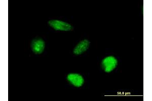 Immunofluorescence of purified MaxPab antibody to AFF4 on HeLa cell. (AFF4 抗体  (AA 1-365))