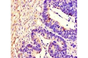 Immunohistochemistry (IHC) image for anti-Protein tyrosine Phosphatase, Receptor Type, S (PTPRS) (AA 25-128) antibody (ABIN7167518)