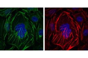 Immunofluorescence analysis of HepG2 cells using ACTA2 mouse mAb (green). (Smooth Muscle Actin 抗体)