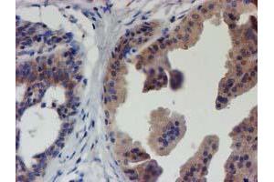 Immunohistochemical staining of paraffin-embedded Human breast tissue using anti-EIF4E2 mouse monoclonal antibody. (EIF4E2 抗体)