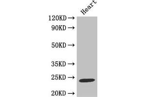 Western Blot Positive WB detected in: Mouse heart tissue All lanes: TIMP1 antibody at 2 μg/mL Secondary Goat polyclonal to rabbit IgG at 1/50000 dilution Predicted band size: 24 kDa Observed band size: 24 kDa (TIMP1 抗体  (AA 24-207))