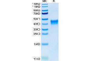 Human BST1 on Tris-Bis PAGE under reduced condition. (BST1 Protein (AA 29-293) (His tag))