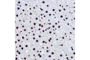 Immunohistochemistry of paraffin-embedded rat liver using BRMS1 Rabbit mAb (ABIN7265928) at dilution of 1:100 (40x lens). (BRMS1 抗体)