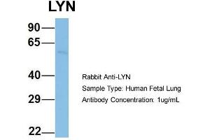 Host: Rabbit  Target Name: LYN  Sample Tissue: Human Fetal Lung  Antibody Dilution: 1.