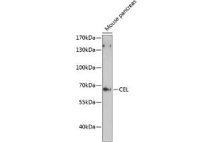 Western blot analysis of extracts of mouse pancreas, using CEL antibody (ABIN6132072, ABIN6138393, ABIN6138395 and ABIN6216837) at 1:3000 dilution. (Cholesterol Esterase 抗体  (AA 350-550))