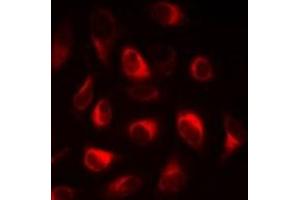 Immunofluorescent analysis of FABP5 staining in A549 cells. (FABP5 抗体)