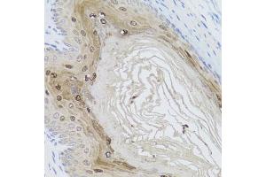 Immunohistochemistry of paraffin-embedded mouse stomach using AMBRA1 antibody (ABIN5970441) at dilution of 1/100 (40x lens). (AMBRA1 抗体)
