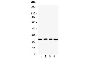 Western blot testing of NPM2 antibody on Lane 1: HeLa (NPM2 抗体  (N-Term))