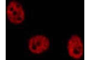 ABIN6274293 staining COLO205 cells by IF/ICC. (MLLT10 抗体  (Internal Region))