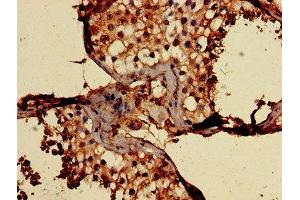 Immunohistochemistry of paraffin-embedded human testis tissue using ABIN7147167 at dilution of 1:100 (CD59 抗体  (AA 26-102))