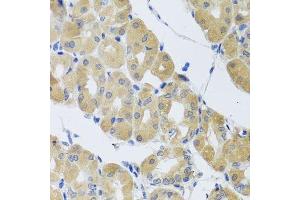 Immunohistochemistry (Paraffin-embedded Sections) (IHC (p)) image for anti-Synaptosomal-Associated Protein, 29kDa (SNAP29) (AA 1-258) antibody (ABIN1682838)