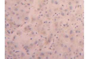 DAB staining on IHC-P; Samples: Human Liver Tissue (FURIN 抗体  (AA 105-221))