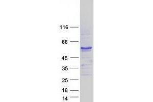 Validation with Western Blot (Aspartate beta Hydroxylase Protein (Transcript Variant 10) (Myc-DYKDDDDK Tag))