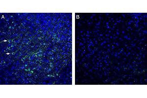 Expression of /LRRC4 in mouse cortex. (LRRC4 抗体  (Extracellular))