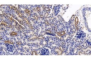 Detection of DDAH2 in Mouse Kidney Tissue using Polyclonal Antibody to Dimethylarginine Dimethylaminohydrolase 2 (DDAH2) (DDAH2 抗体  (AA 31-265))
