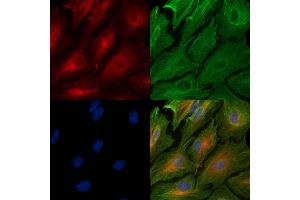 ABIN6259048 and ABIN6274810 staining  cells by IF/ICC.