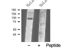 Western blot analysis of TM16J Antibody expression in Hela cells lysates. (ANO9 抗体  (Internal Region))