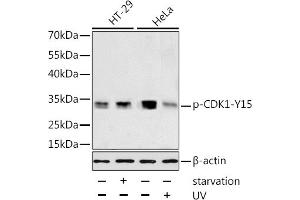 Western blot analysis of extracts of HT-29 and HeLa cells, using Phospho-CDK1-Y15 antibody (ABIN3019442, ABIN3019443, ABIN3019444 and ABIN6225371) at 1:1000 dilution. (CDK1 抗体  (pTyr15))