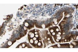 ABIN6267297 at 1/100 staining Mouse intestine tissue by IHC-P.