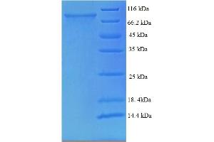 SDS-PAGE (SDS) image for Trichoplein, Keratin Filament Binding (TCHP) (AA 1-498), (full length) protein (His-SUMO Tag) (ABIN5711845)