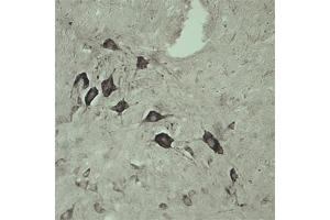 IHC on rat spinal cord using Rabbit antibody to internal part of Vacuolar protein sorting-associated protein 45 (rvps45, Vps45, Vps45a): IgG (ABIN351329) at a concentration of 10 µg/ml. (VPS45 抗体)