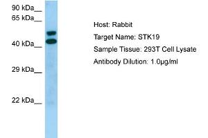 Western Blotting (WB) image for anti-serine/threonine Kinase 19 (STK19) (Middle Region) antibody (ABIN2774428) (STK19 抗体  (Middle Region))
